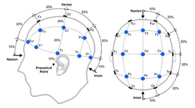International 10-20 System