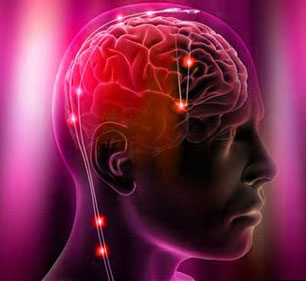 Implanted Electrodes on Brain