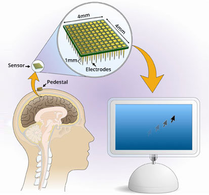 Braingate Technology