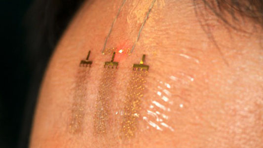 Electronic telepathy tattoos