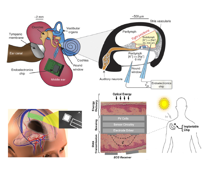 Implantable electronics