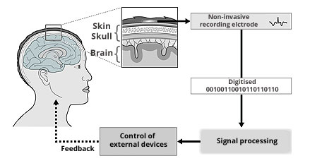 Non-Invasive Block Diagram