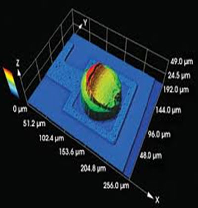 Confocal Microscopy