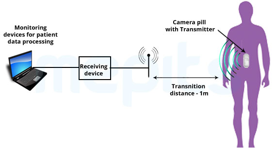 Working of Electronic Pill